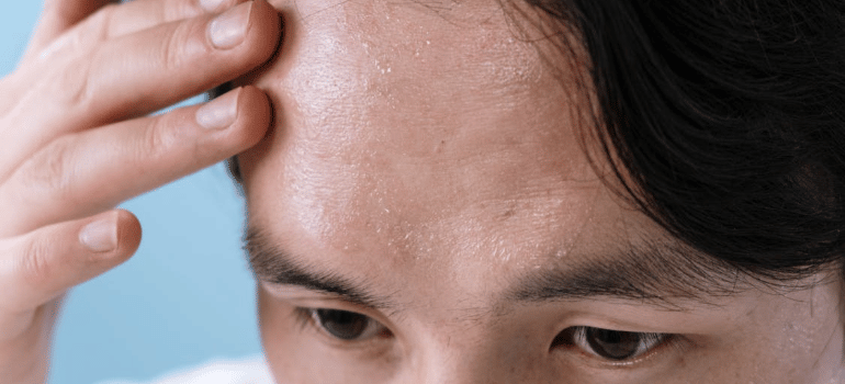 A close-up of a man touching his sweaty forehead.
