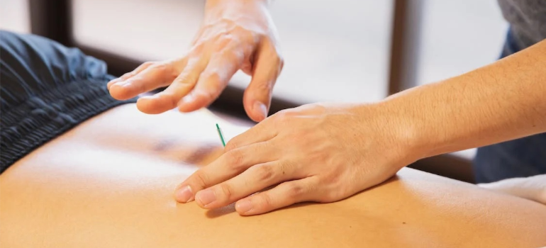 A close-up of a person receiving acupuncture as one of alternative therapies for addiction, embracing a holistic approach to recovery.