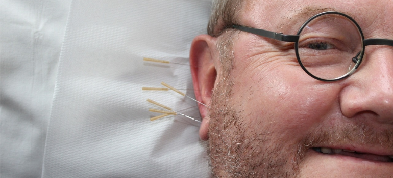 A close-up of a man having received acupuncture in drug addiction treatment.