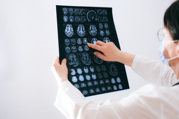 A doctor looking at MRI scans of a brain