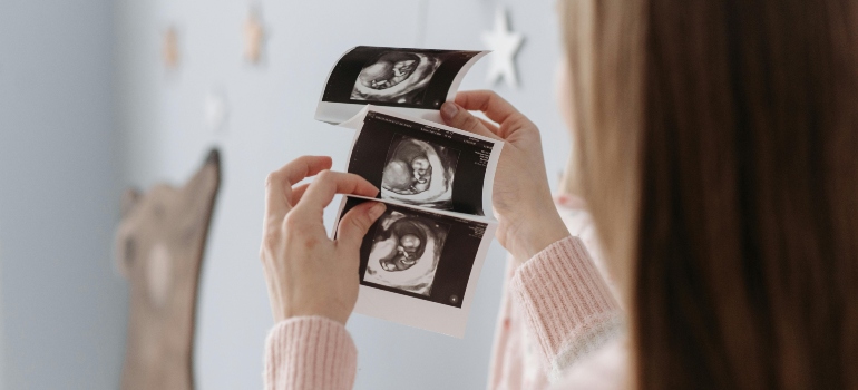 A woman holding ultrasound images