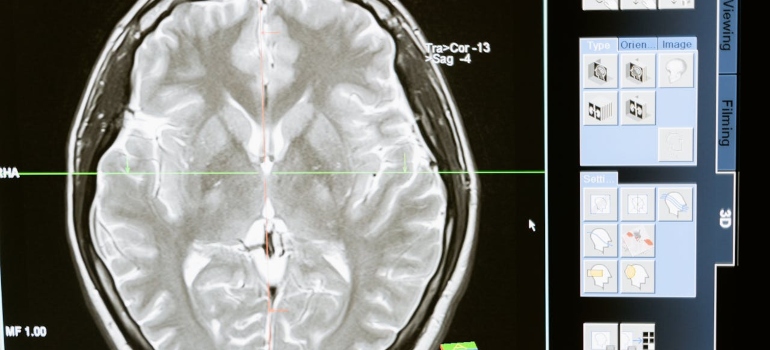 This picture of a brain structure symbolizes whether there Are Some People Predisposed to Addiction?