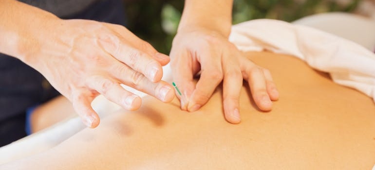 Man doing acupuncture on a man's back.