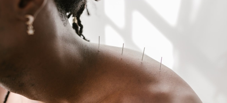 A man doing acupuncture in a holistic therapy session.