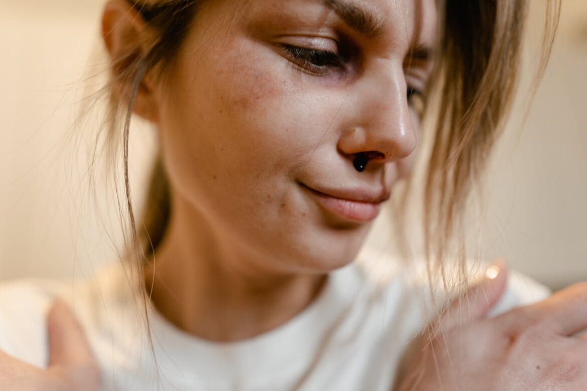 a woman having nosebleed from cocaine